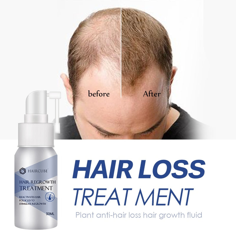 Anti Hair Loss Spray